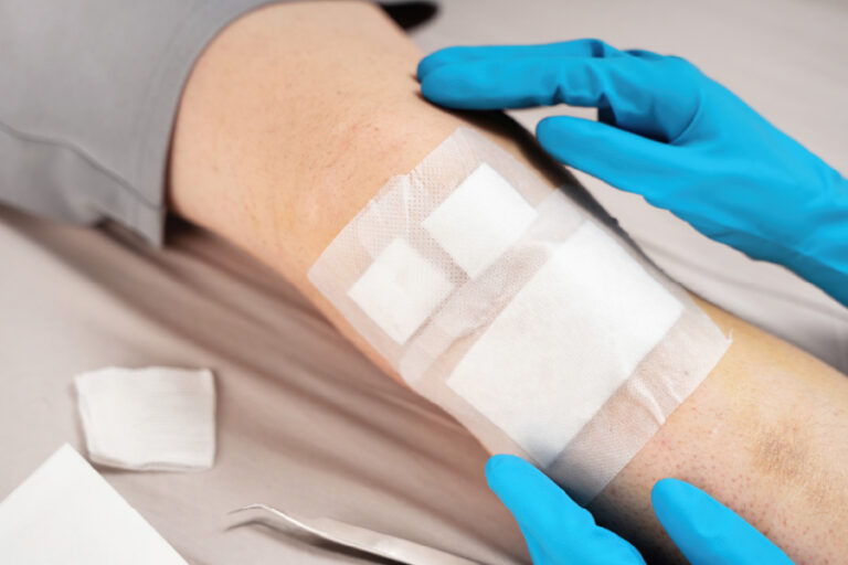 Enfermera a domicilio para manejo de heridas y curaciones
